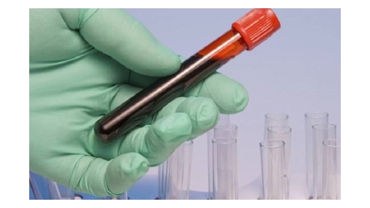 Проведен отбор проб крови КРС в рамках эпизоотического мониторинга