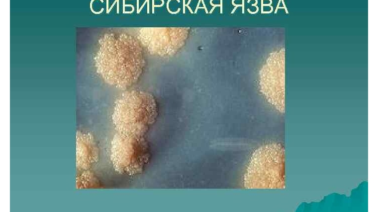 Сибирская язва